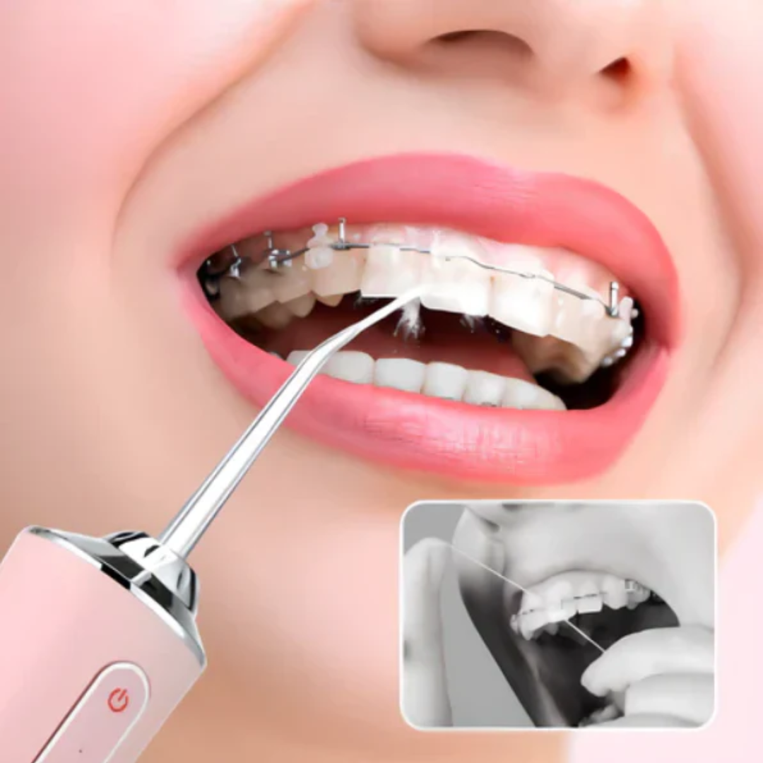 IRRIGADOR BUCAL, LIMPIEZA PROFUNDA + ENVÍO GRATIS🎁